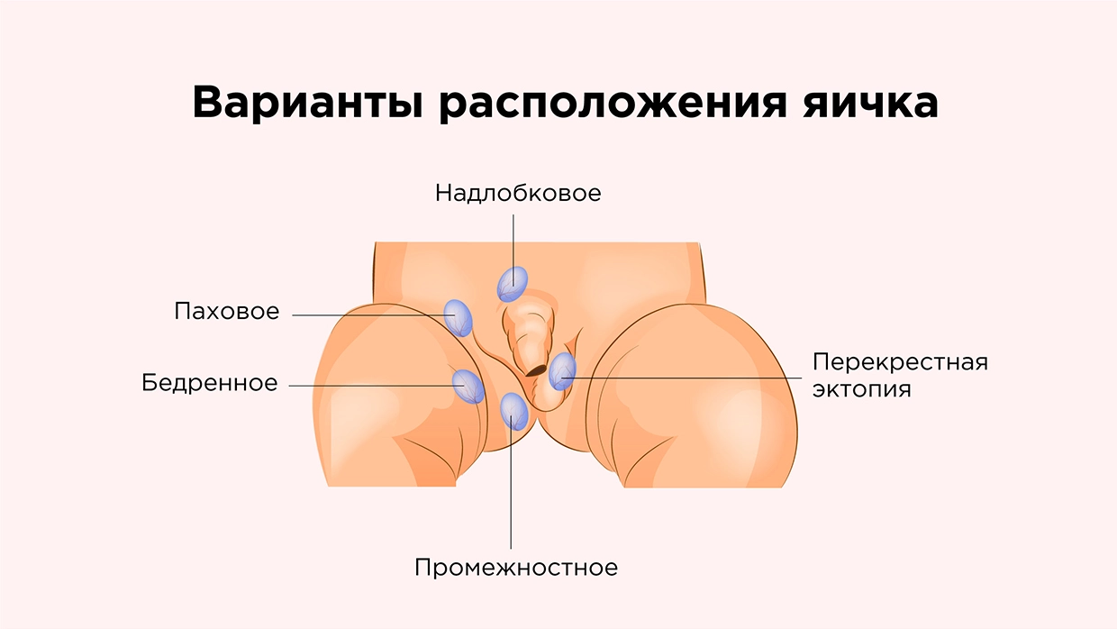 Парни с одним яйцом | Если у тебя одно яйцо это не страшно. | VK